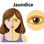 Yellow Eyes Meaning: Medical Causes, Art Symbolism & Drawing Guide