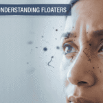 Seeing Black Spots in Your Vision? Causes, Symptoms, and When to Seek Help